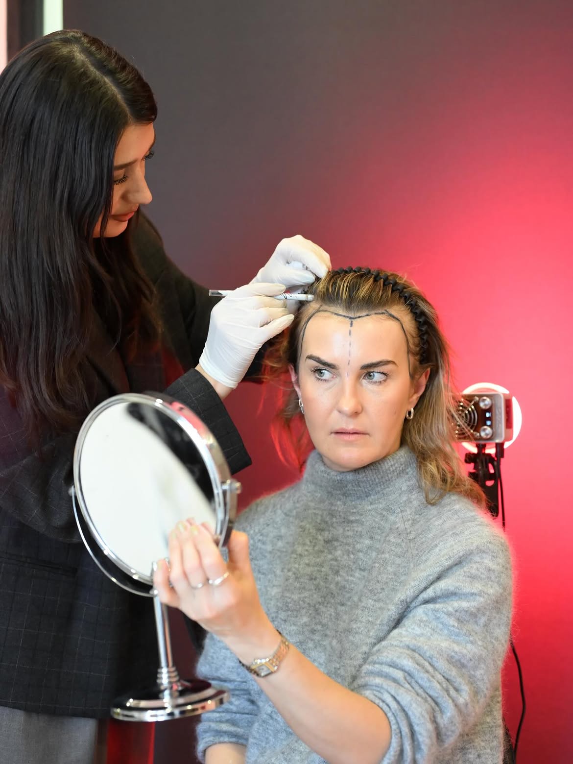 Ärztin zeichnet die Haarlinie einer Patientin für eine Haartransplantation bei Frauen ein